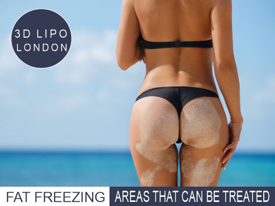 fat freezing treatment Areas